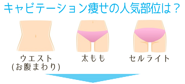 キャビテーションの人気部位